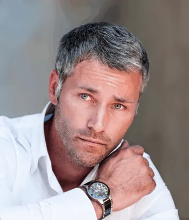 How discreet is a RESTORE Hair No-Shave FUE hair transplant for working professionals?