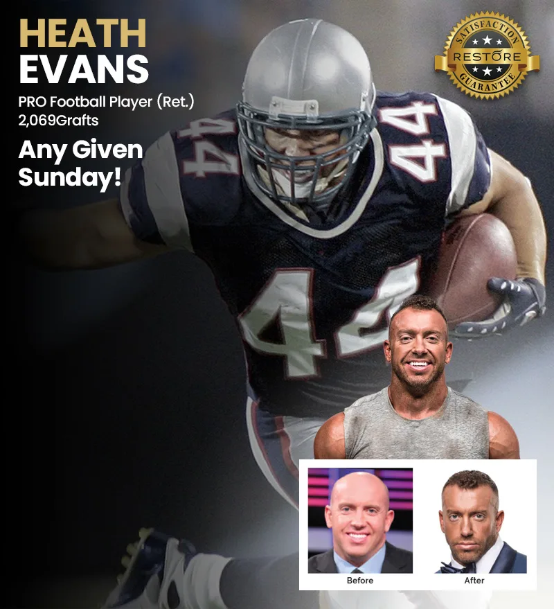 Heath Evans RESTORE hair restoration results banner
