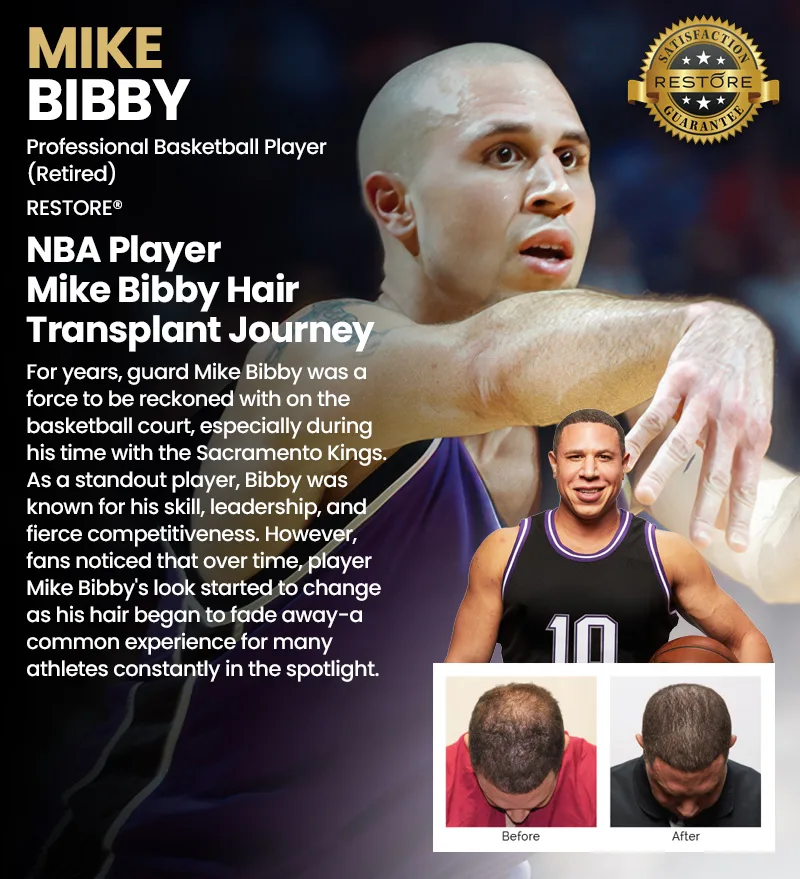 Mike Bibby RESTORE hair restoration results banner