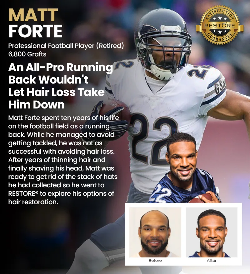 Matt Forte RESTORE hair restoration results banner