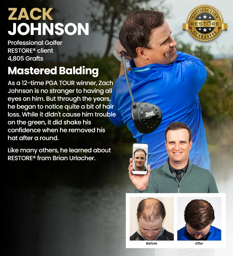 Zach Johnson RESTORE hair restoration results banner