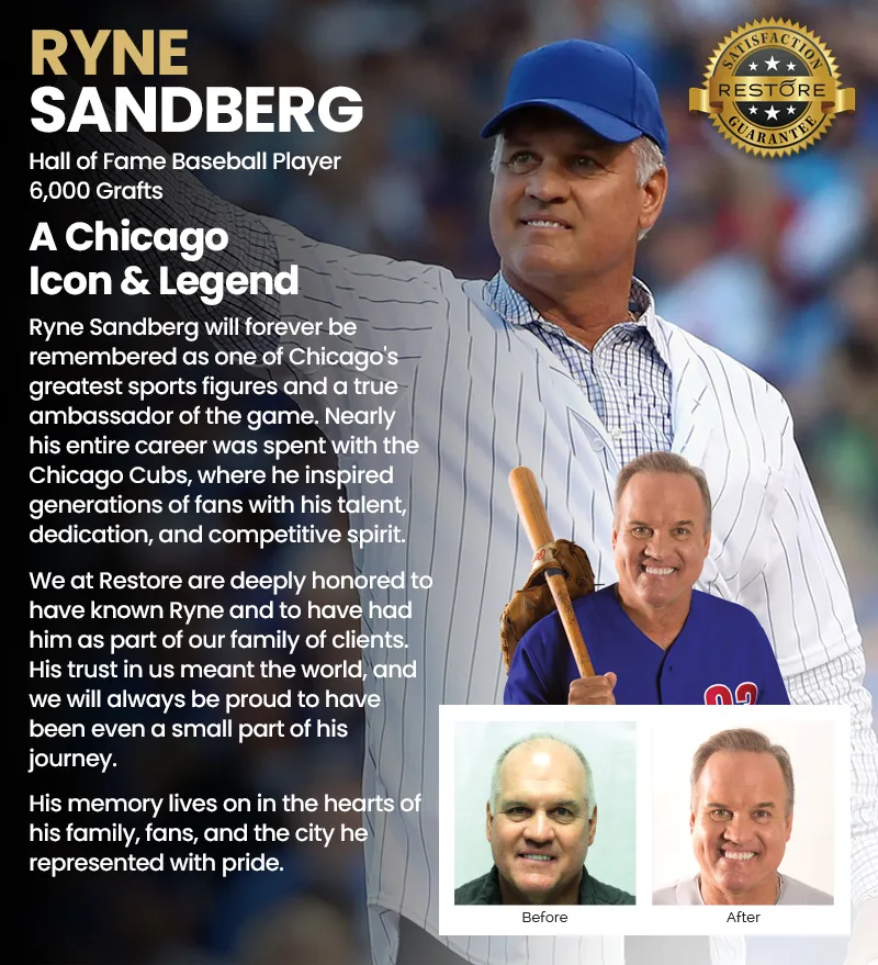 Ryne Sandberg RESTORE hair restoration results banner