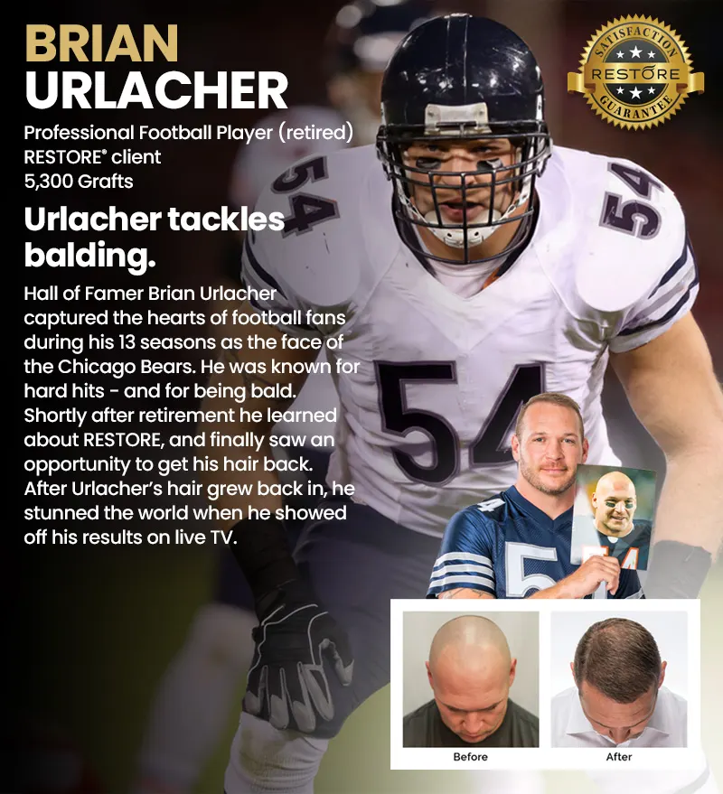 Brian Urlacher RESTORE hair restoration results banner mobile