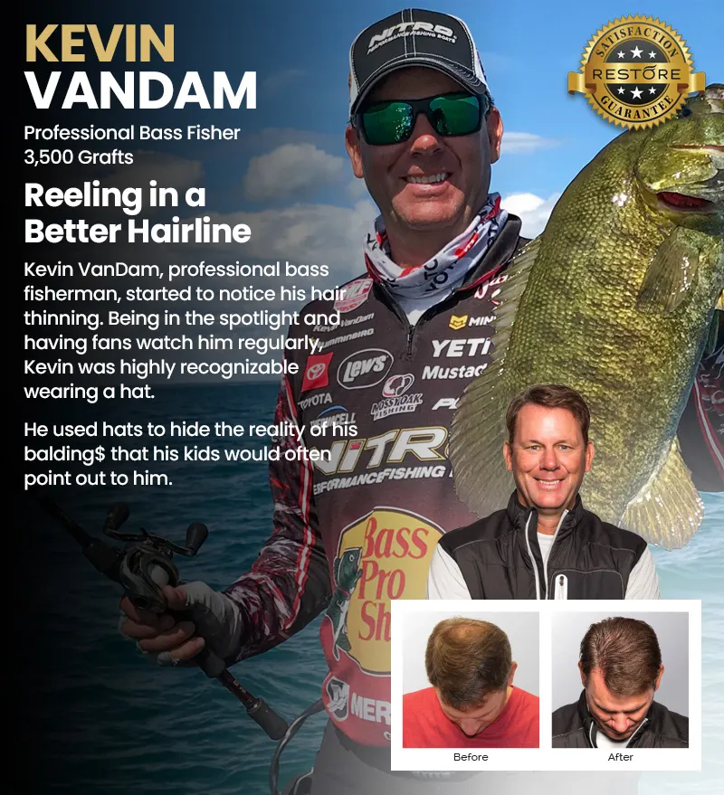 Kevin VanDam RESTORE hair restoration results banner mobile