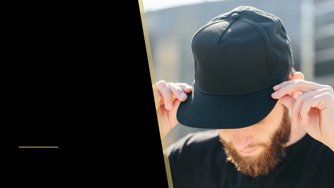 Growing Hat Collection? Are You Experiencing Hair Loss?