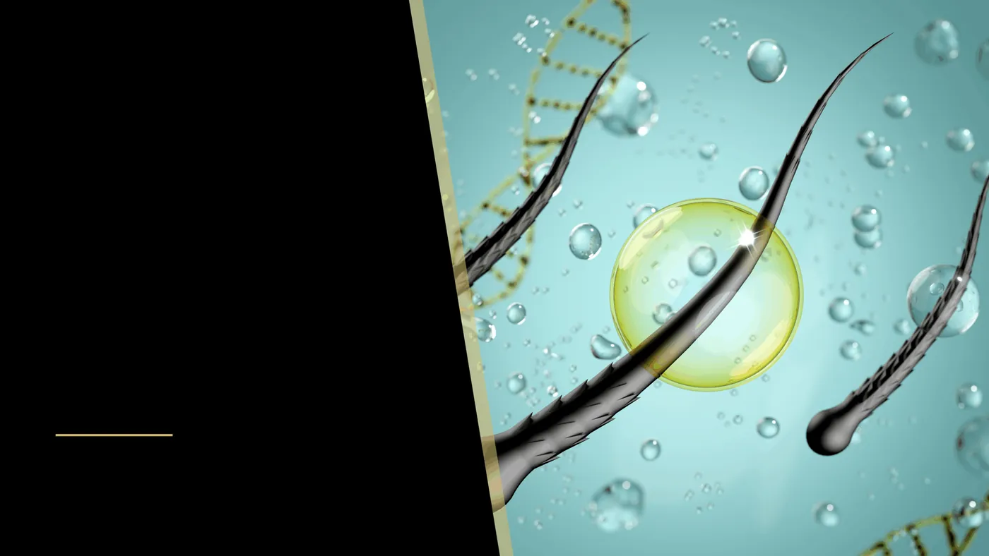 Who is a Good Candidate for Hair Transplantation?