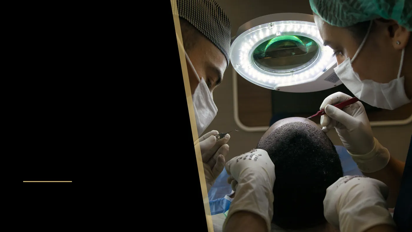 Who Invented FUE Hair Transplant? 30 Years of Hair Transplant History