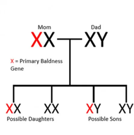 male pattern baldness Gene male pattern baldness Gene