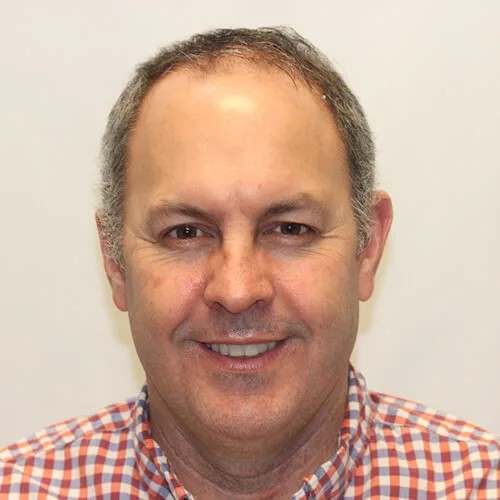 Jamie S Before Hair Transplant Results