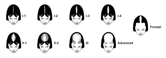 Ludwig Scale
