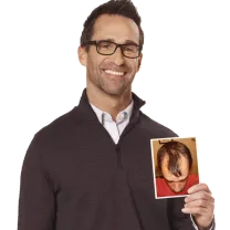Doug M. before and after his RESTORE hair restoration procedure