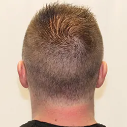 Client Daniel T. progress 10 Days After