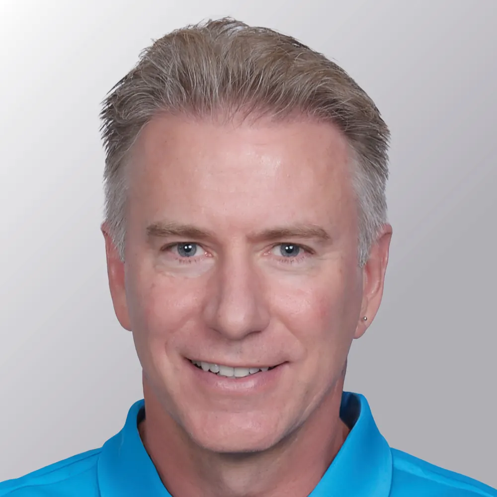 Rick M. after hair transplant
