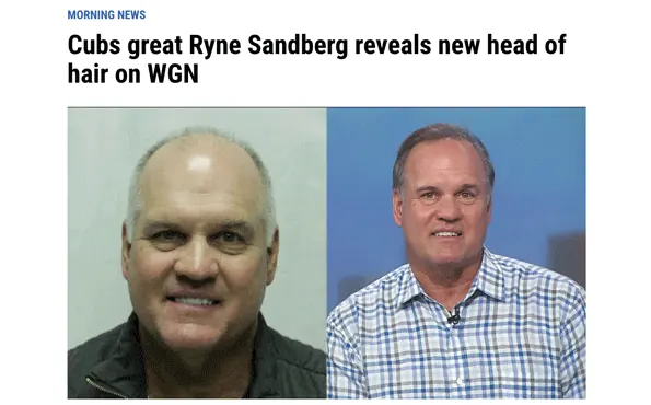 Cubs great Ryne Sandberg reveals new head of hair on WGN