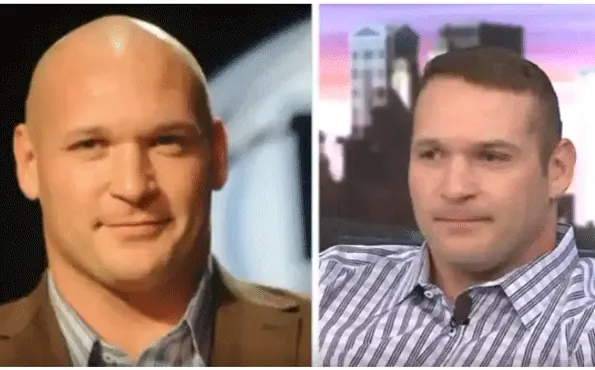 Former NFL Player Brian Urlacher Shows Off Hair Transplant