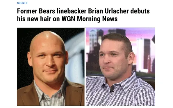 Former Bears linebacker Brian Urlacher debuts his new hair.