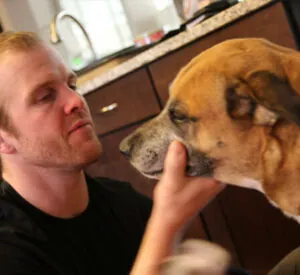 Bryan Bickell After Hair Transplant