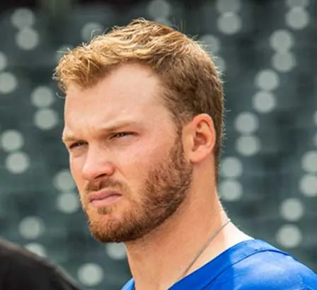 Ian Happ Hair Transplant