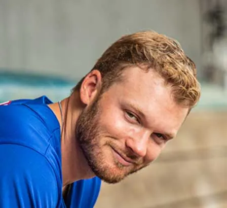 Ian Happ Hair Transplant