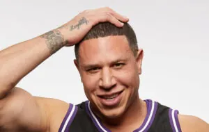 Mike Bibby Hair Transplant