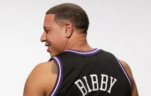 Mike Bibby Hair Transplant