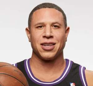 Mike Bibby Hair Transplant