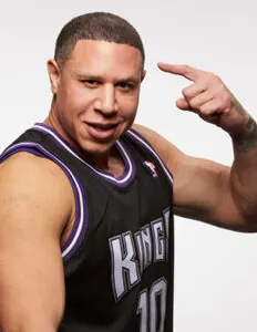 Mike Bibby Hair Transplant