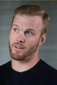 Bryan Bickell After Hair Transplant
