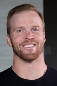 Bryan Bickell After Hair Transplant