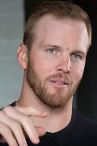 Bryan Bickell After Hair Transplant