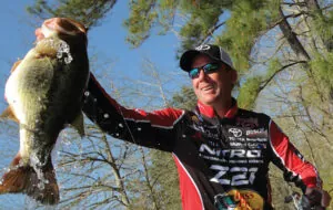Kevin VanDam Hair Transplant