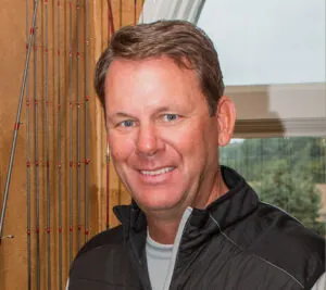Kevin VanDam Hair Transplant