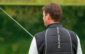 Kevin VanDam Hair Transplant