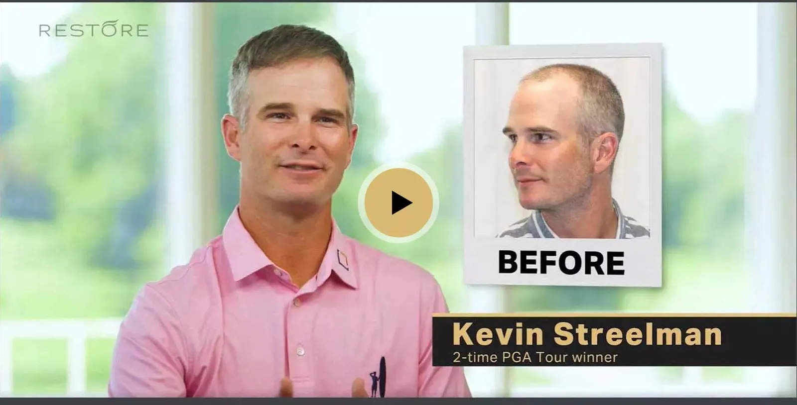 Kevin Streelman hair transplant story