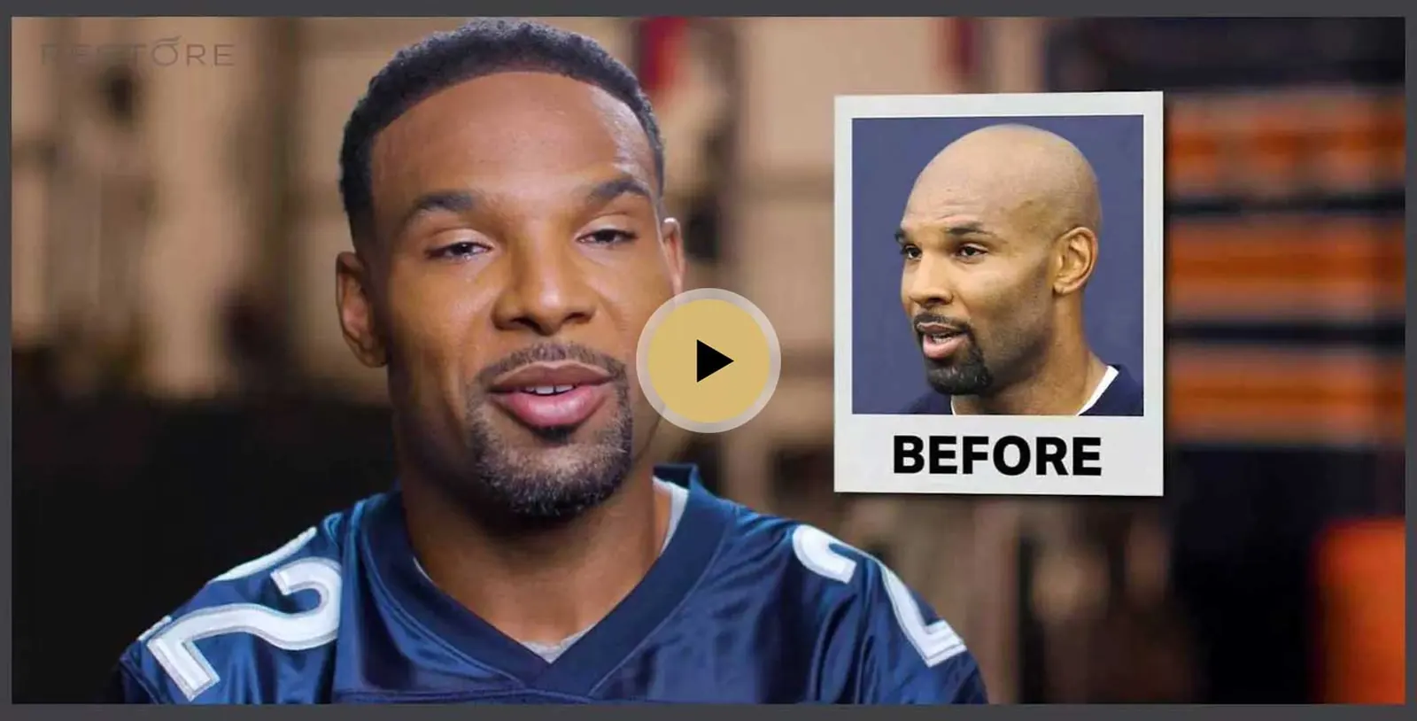 Matt Forte's Strong Hold: How a Hair Transplant Restored His Confidence and Game-Ready Look