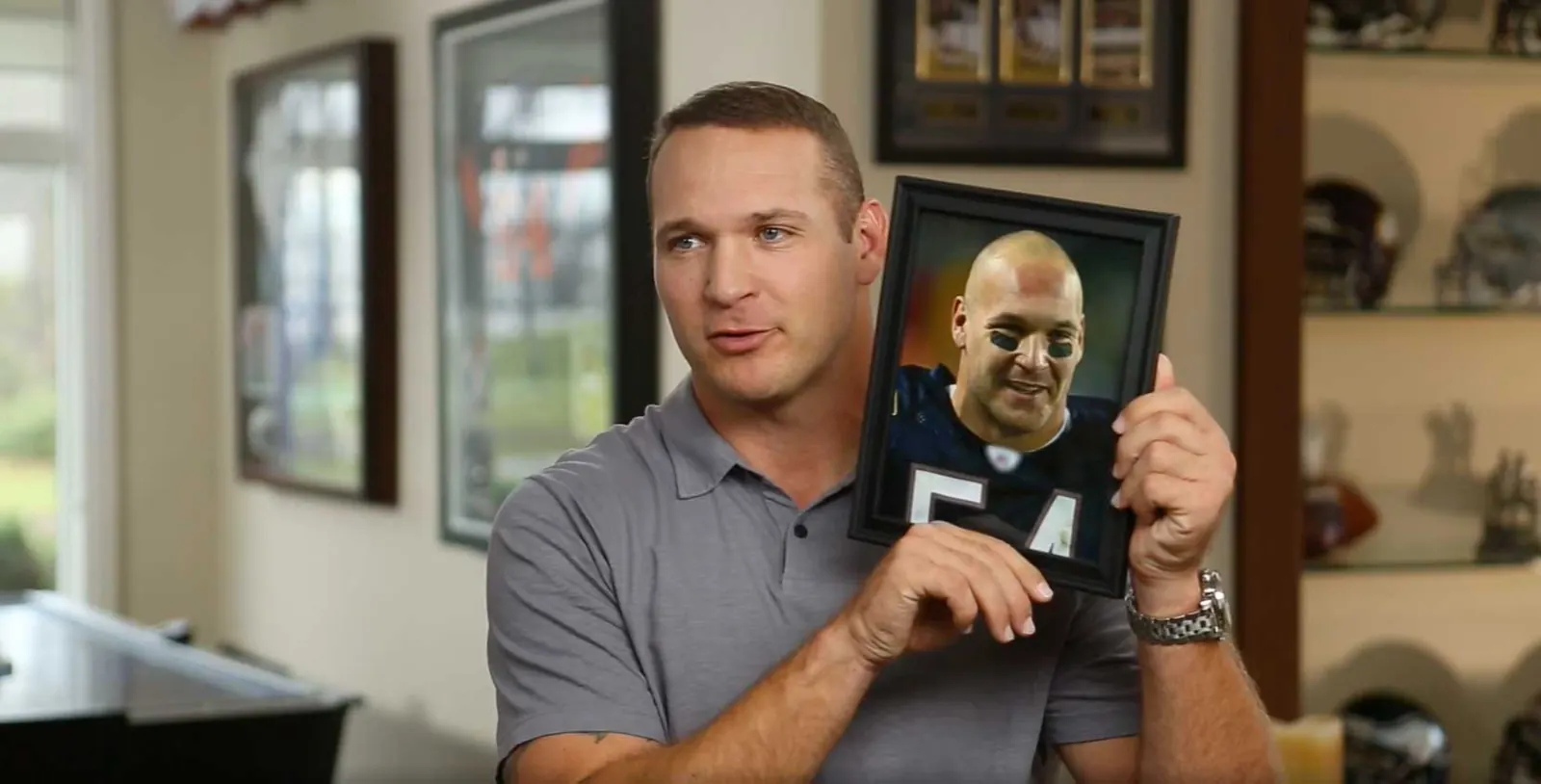 Brian Urlacher hair transplant story