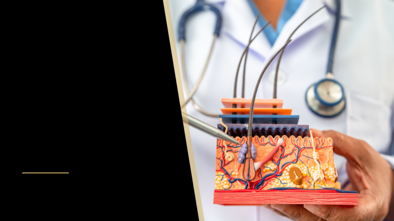 Understand the Common Elements that Cause Hair Loss 10 a hair follicle