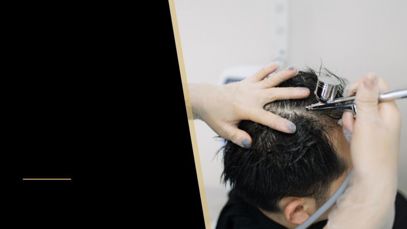 Types of Hair Loss Treatments 36 Hair procedure for a man