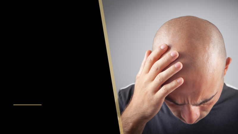 The Impact of Hair Loss & Balding 4 bald man looking down