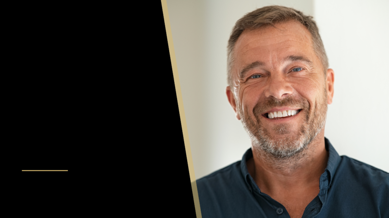 Can You Conceal a Hair Transplant? 26 a middle age man