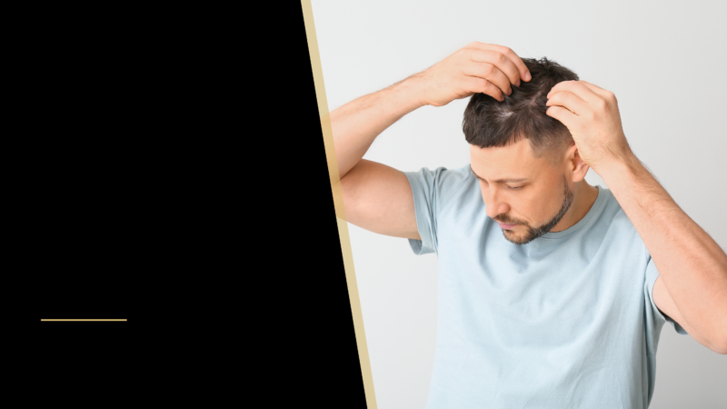 What Percentage of Hair Transplants are Successful? 6 a man looking at his hair
