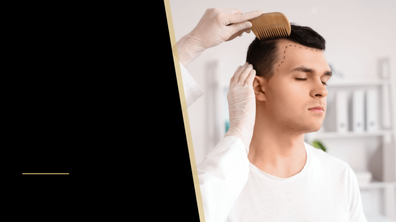 Is There Really a Permanent Cure for Baldness? 16 a man getting a hair restoration consultation