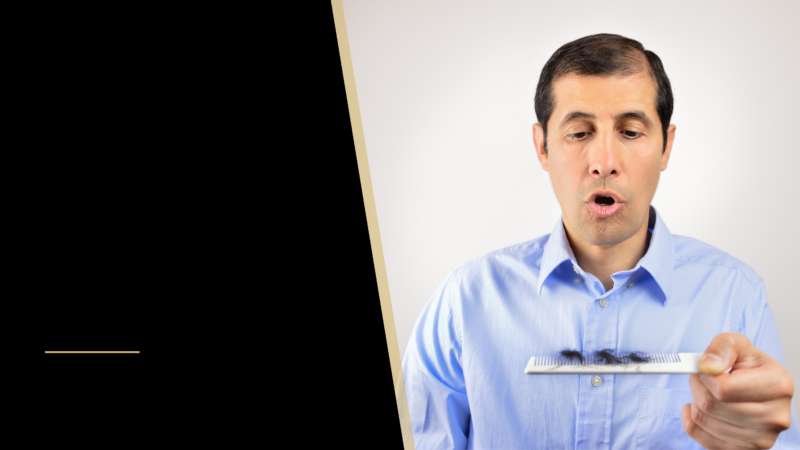 Alopecia vs Balding vs Male Pattern Baldness: What's Causing Hair Loss? 36 a balding man
