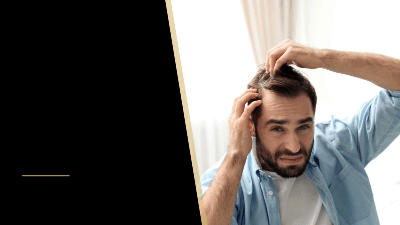 Recognizing the First Signs of Hair Thinning 24 A man touching his hair