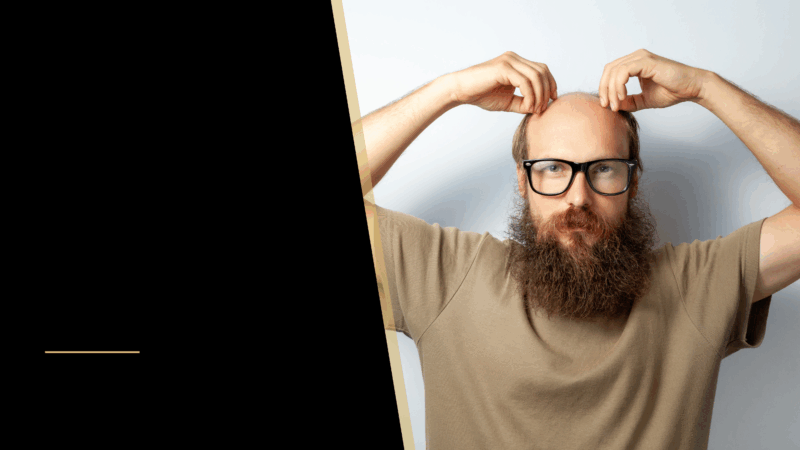 A balding man is looking at his head