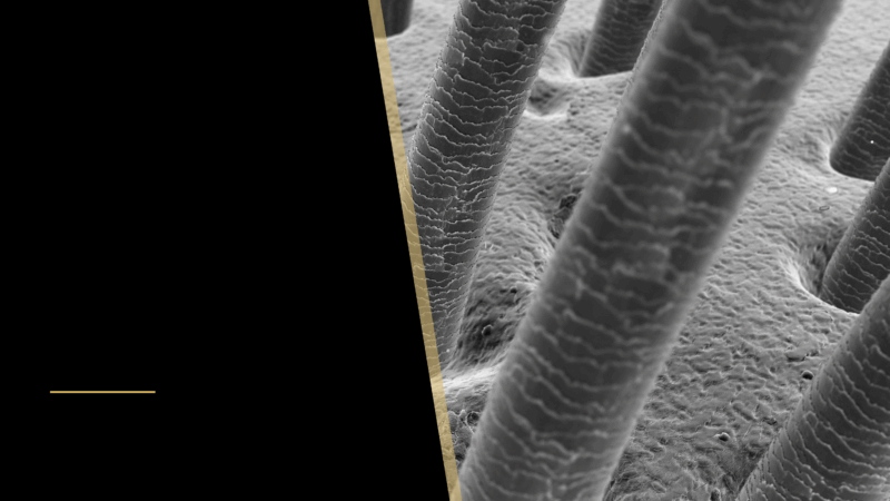 Hair Transplant: An Effective Way of Hair Restoration 26 A picture of a hair close up