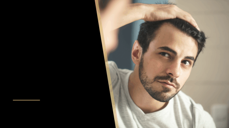 Correcting a Hair Transplant - 3 Ways to Fix a Bad Hair Restoration 34 A man looking at his hair