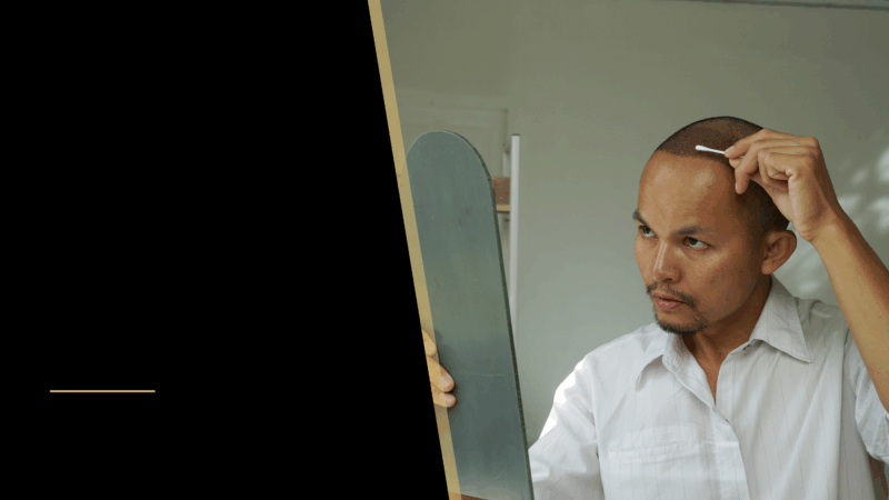 A man doing his post operation care