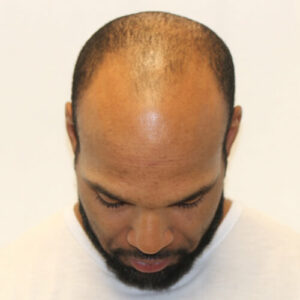 matt_f_before_top_v2