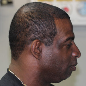 deion_s_after_right
